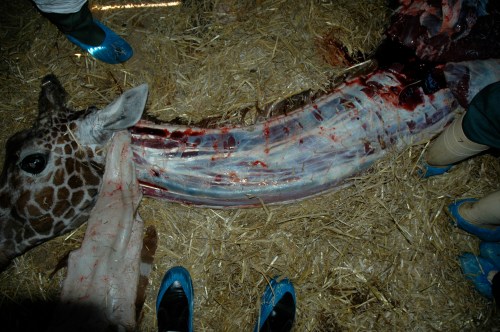 Left side of the neck. Purplish-blue vessel is the jugular vein, shown next.