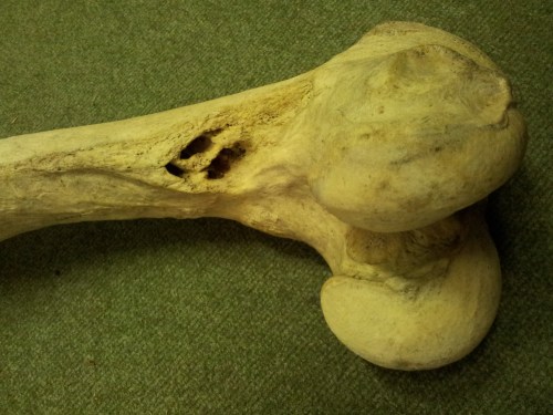 femur-path