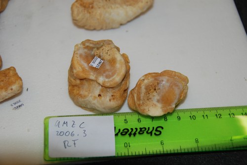 Nasty osteoarthritis wearing away the bone at the joint surface. Most cases occurred in the most distal joint.