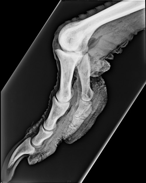 That two-toed foot... but did you know that normally the missing 2nd toe is still there as a fibrous remnant on the 3rd toe?