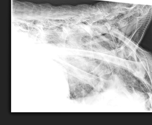 Shoulder and chest. Hard to image; thick and dense (still was frozen).