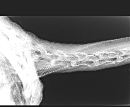 Base of neck and shoulder