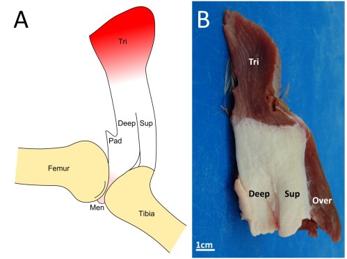 Fatty knee extensor tendon of emus, lacking a patella. The fatty tissue is split into superficial (Sup) and deep regions, with a pad corresponding to the fat pad in other birds continuous with it and the knee joint meniscus (cushioning pad). The triceps femoris (knee extensor) muscle group inserts right into the fatty tendon, continuing over it. A is a schematic; B is a dissection.