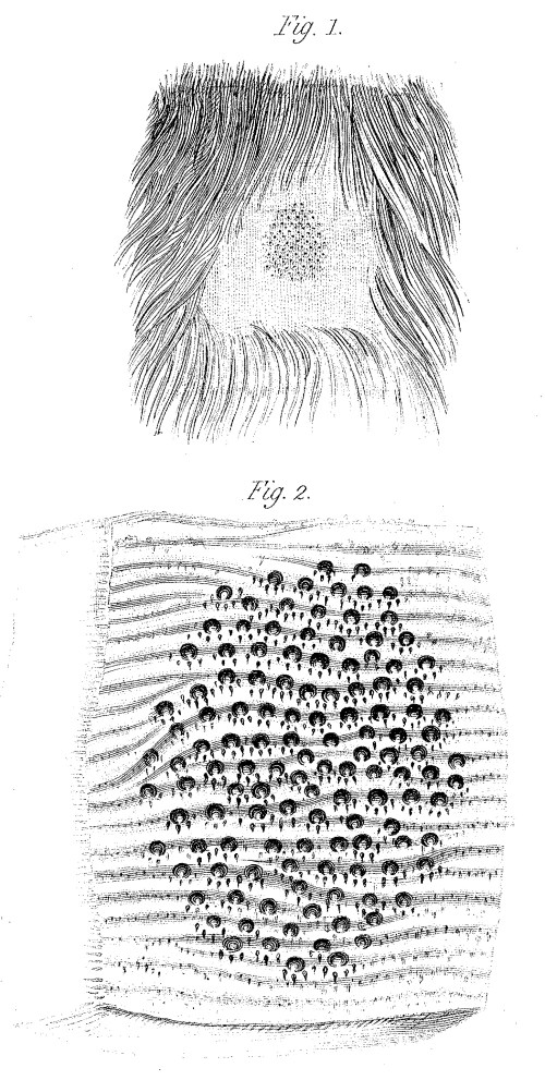 "Areola" of the female platypus in the abdominal region, with embiggened version below. From: Richard Owen, On the Mammary Glands of the Ornithorhynchus paradoxus. Philosophical Transactions of the Royal Society of London Vol. 122 (1832), pp. 517-538 http://www.jstor.org/stable/107974 FREE!